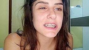 Cum on butterfly braces